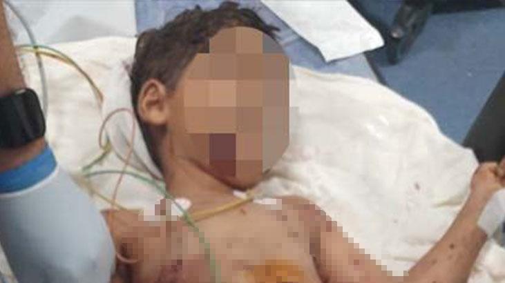 5 yaşındaki çocuğa sokak köpekleri saldırdı