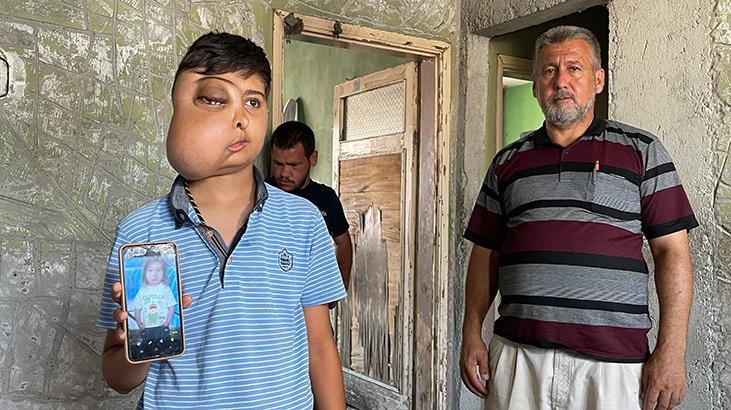 Enes’in dramı: İki farklı yüzü var gibi görünüyor, tek isteği tedavi olmak