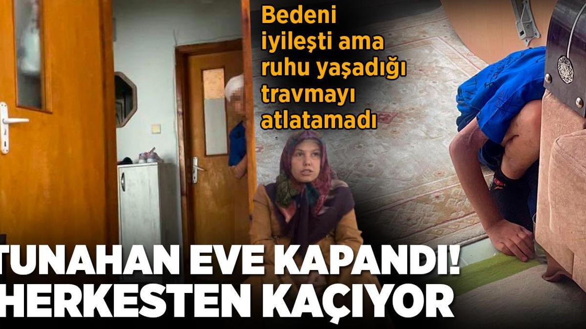 Köpeklerin ağır yaraladığı Tunahan eve kapandı, herkesten kaçıyor: Yaşaması bile bir mucize