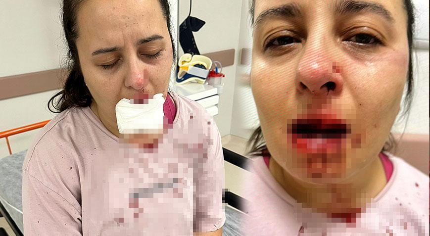 Amca dehşeti! Balyozla saldırdı çenesini ve 1 dişini kırdı