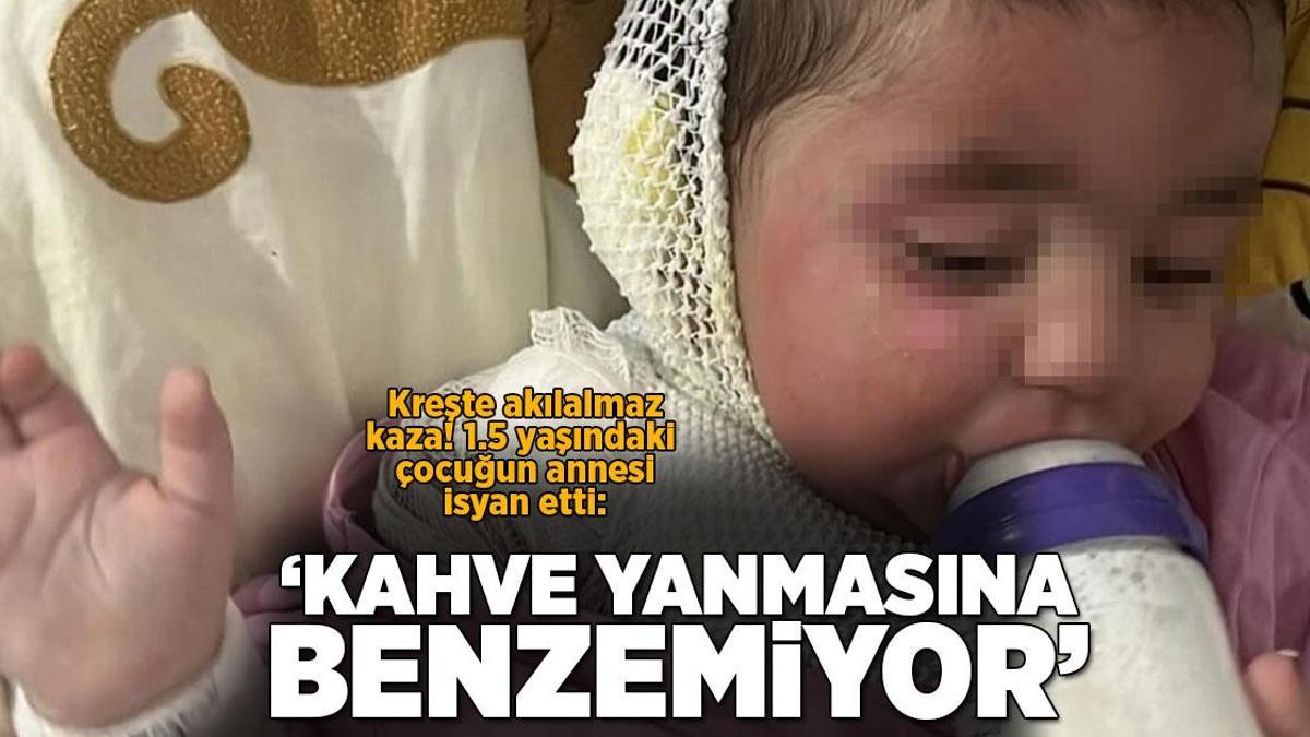 Kreşte 1,5 yaşındaki çocuk kahve ile yandı! Anne isyan etti