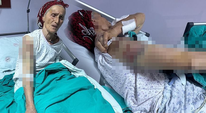 65 yaşındaki kadın dehşeti yaşadı! 50 dikiş atıldı