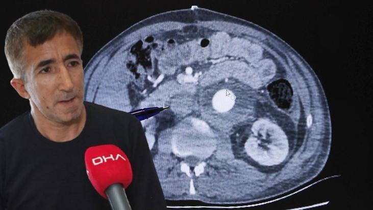 Masaj için gitti, hayatı kurtuldu! ‘Çok tarhana çorbası içiyorum, ondandır’ dedi, gerçek şoke etti