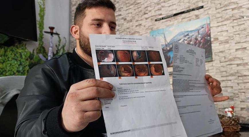 Yediği tatlı sonu oluyordu! Midesinde 3 adet cam parçası çıktı