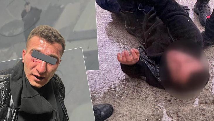 İstanbul’da 2 polise bıçakla saldırı! İfade ortaya çıktı: O an karar verdim