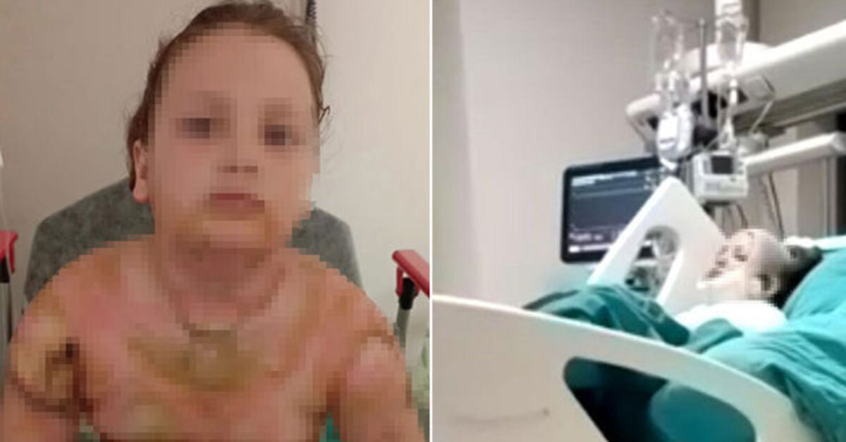 Adana haberleri: Okulda sobada ısınırken küçük kız yandı | SON DAKİKA HABERLER | Son dakika haberleri