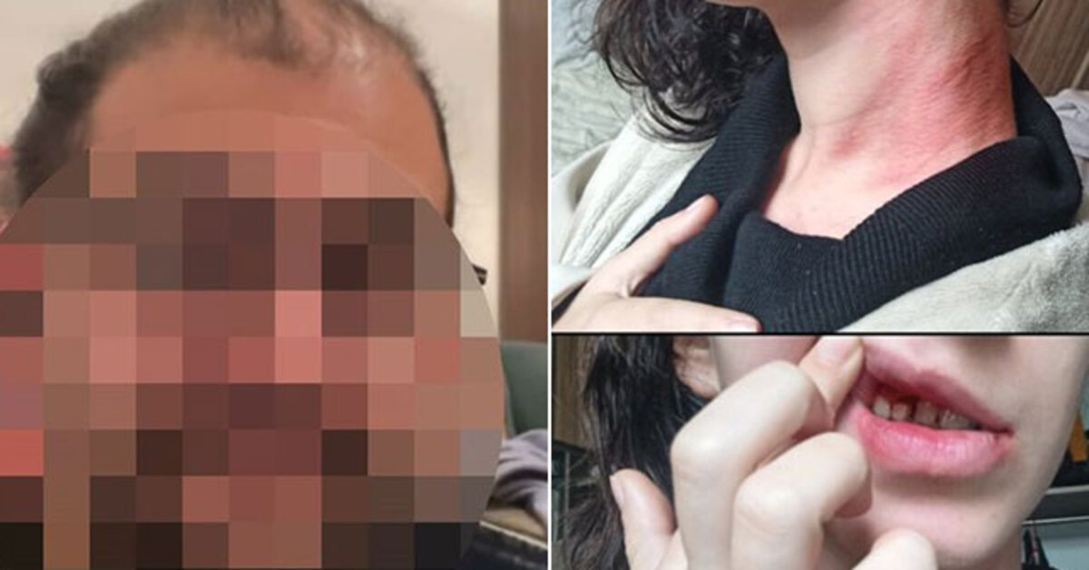 Ankara haberleri:  Genç kıza kafa atıp boğazını sıktı! Katil adayı komşu | SON DAKİKA HABERLER | Son dakika haberleri