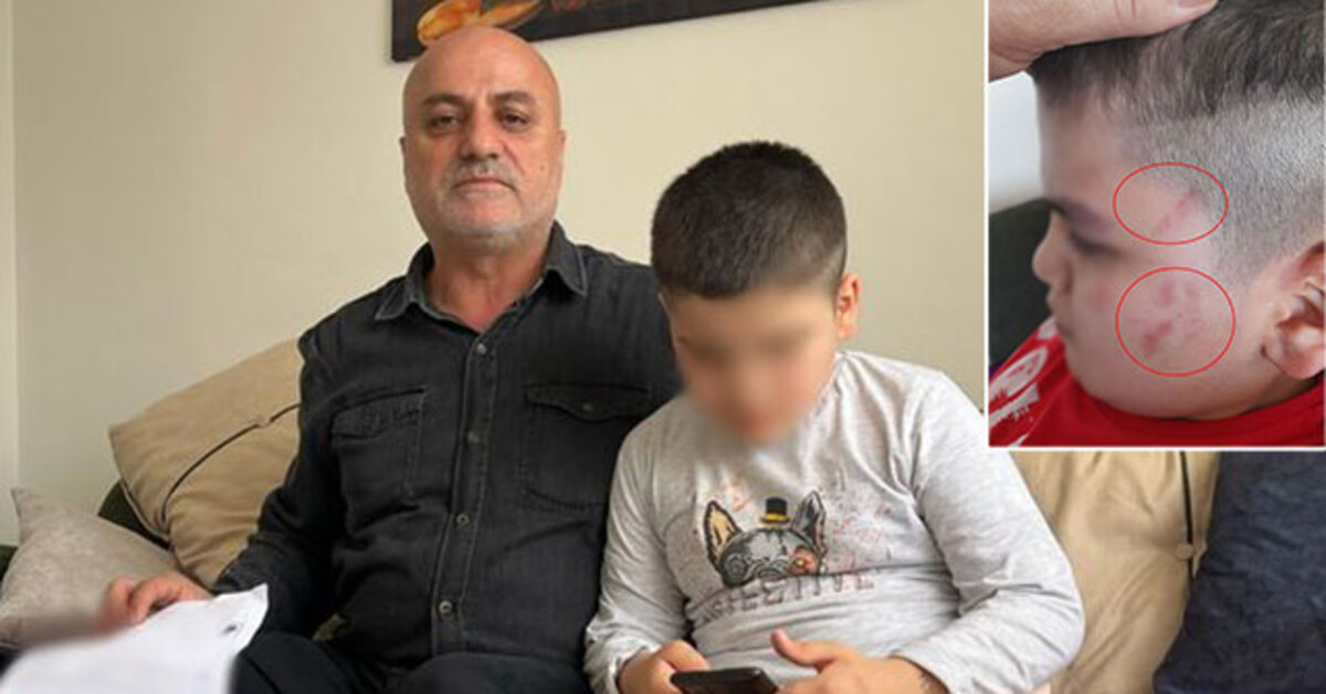 Bursa haberleri: Öğretmen açığa alındı! Otizmli çocukta 54 morluk | SON DAKİKA HABERİ | Son dakika haberleri