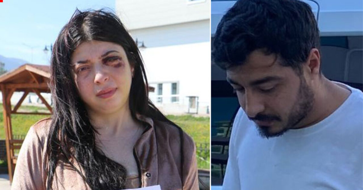 Samsun haberleri: Önce taciz edildi! Sonra sokakta darp! Damla Korkmaz dehşeti yaşadı | Son dakika haberleri