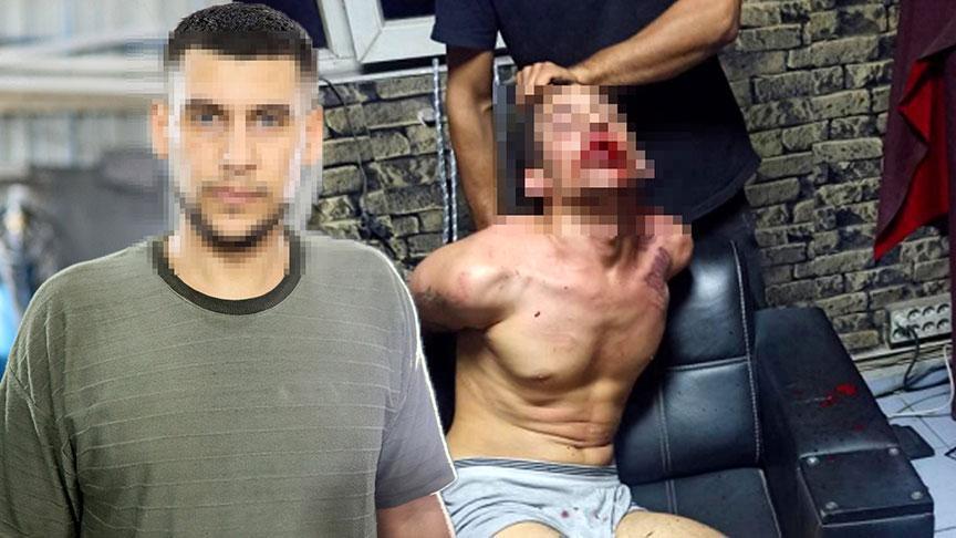 Dişleri kırılıp, hamam böceği yedirildi! 3 günlük işkencede şok rapor
