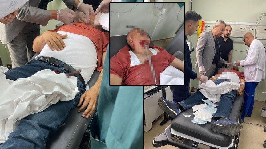 Hatay’da feci olay! İnşaat işçisinin yüzüne demir saplandı