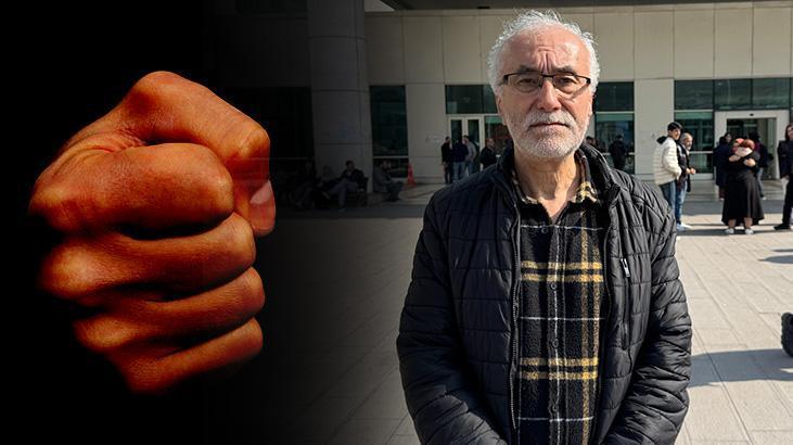 İngiliz boksörden taksi şoförüne feci dayak: Yüz şekli tamamen değişmiş