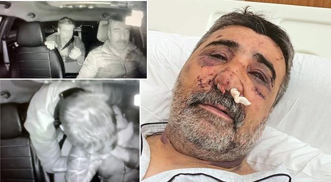 Son dakika haberi: Taksici dehşet anı anlattı! Ellerini gözüme sokmaya, ısırmaya, öpmeye başladı