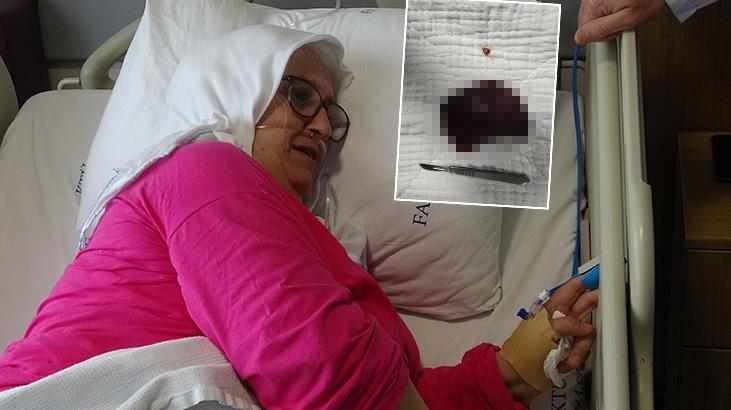 Yuttuğu kuruyemiş akciğerini çürüttü: Bir daha yemem