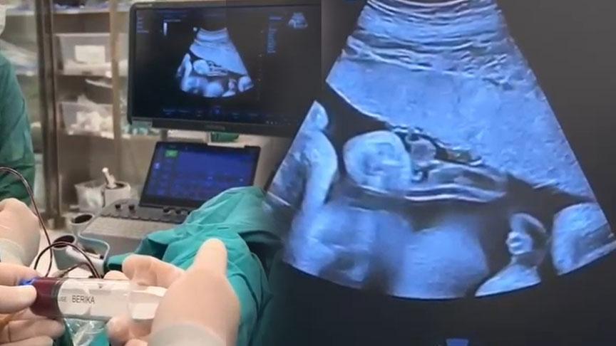Bebeğini kaybetti, 2’nci kez hamile kalınca doktorlar fark etti! ‘Anne karnında transfer ettik’