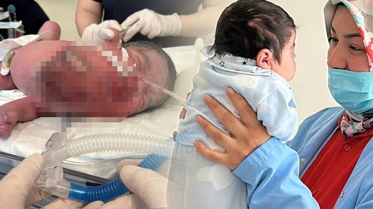 Eymen bebek dünyada 7’inci vaka olarak tarihe geçti: Yaşama şansı yoktu