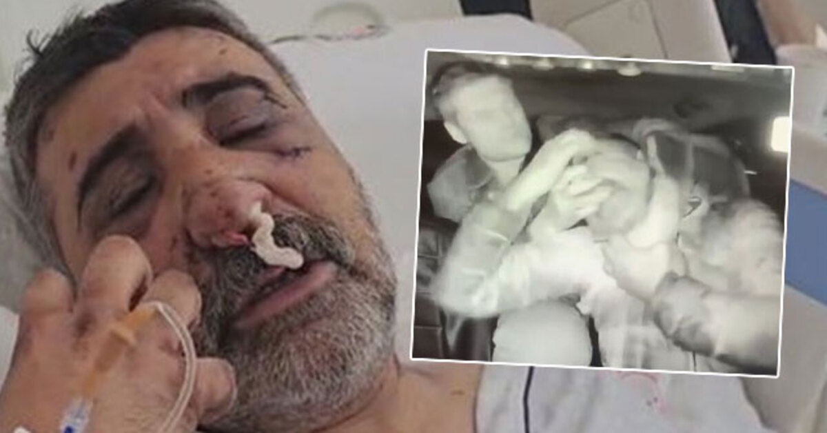 İngiliz boksörün darp ettiği taksici konuştu: Gözlerimi oymaya çalıştı | HABERLER | Son dakika haberleri