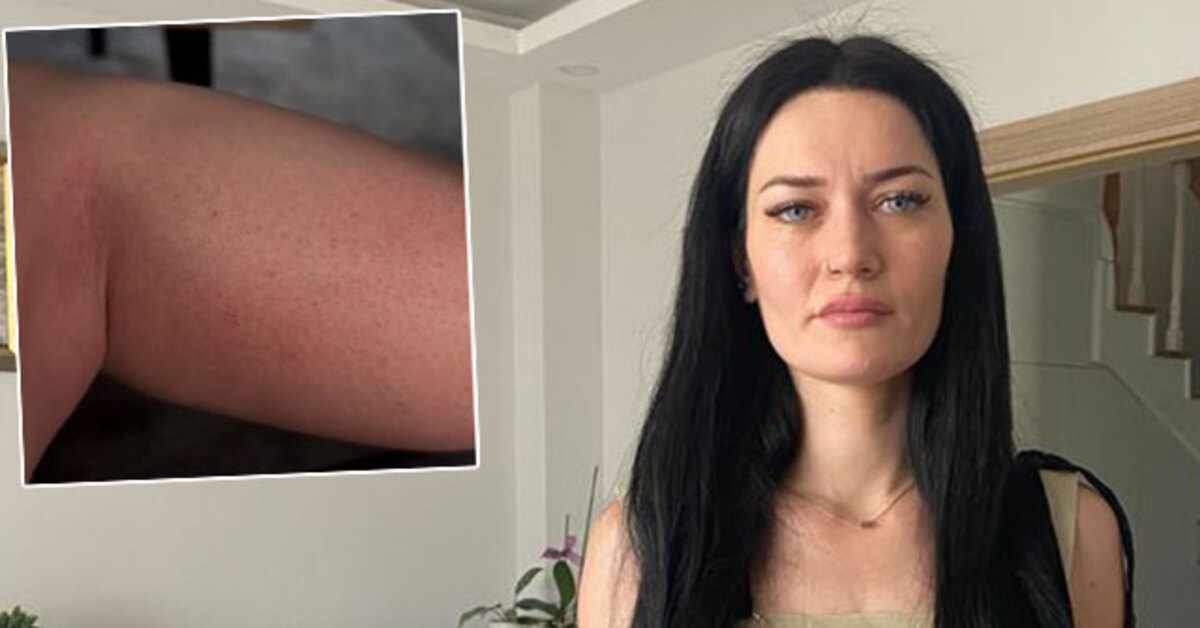 Kocaeli haberleri: Solaryumda unutulmuştu… Karar çıktı! | Son dakika haberleri