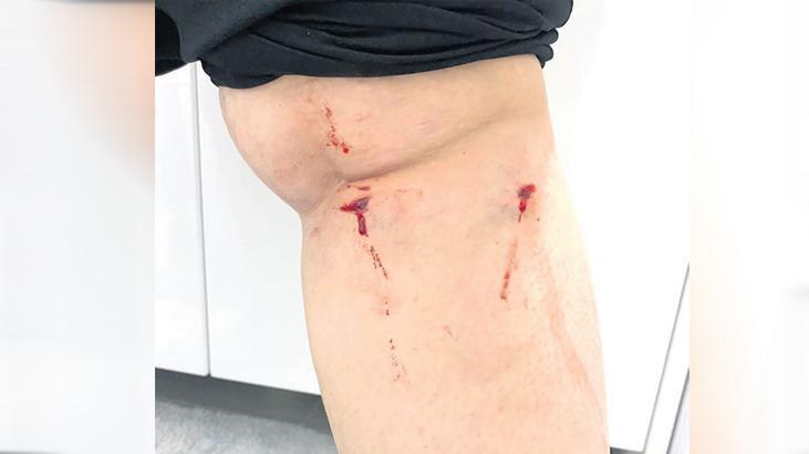 YTÜ kampüsünde öğrenciye köpek saldırdı